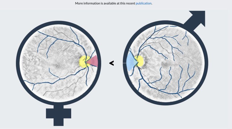 slider_fundus2gender.jpg